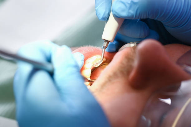 Best Emergency Pediatric Dental Care in Buchanan, VA