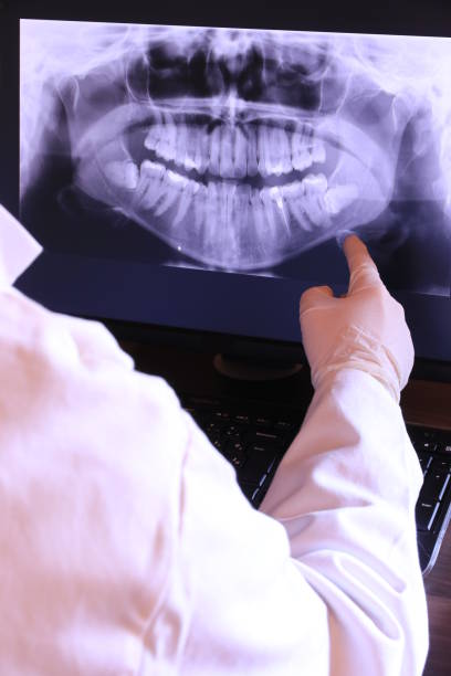 Best Knocked-Out Tooth (Avulsed Tooth) Treatment in Buchanan, VA