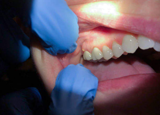 Best 24-Hour Emergency Dental Care in Buchanan, VA