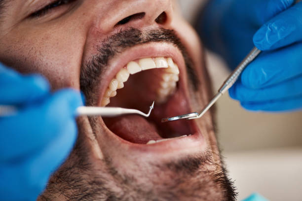 Best Emergency Cosmetic Dentistry (e.g., broken veneers) in Buchanan, VA