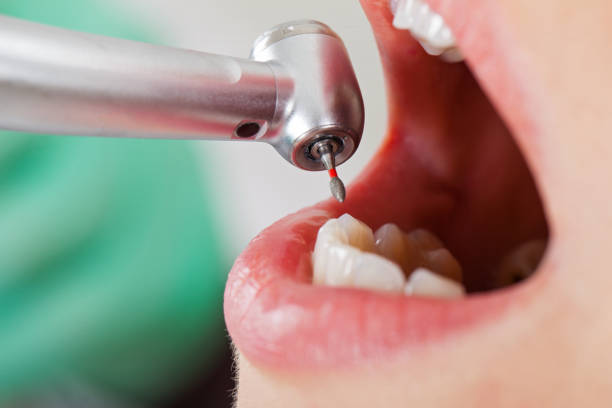 Best Emergency Care for Gum Disease in Buchanan, VA